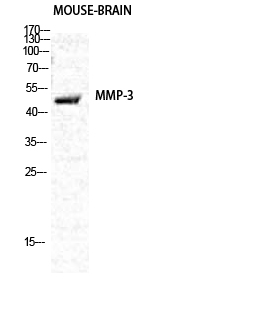 MMP3