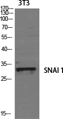 SNAI1