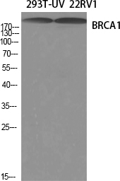 Rabbit Polyclonal Antibody to BRCA1