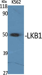 LKB1