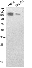 SREBP1