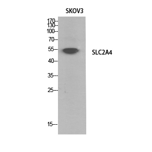 Glucose Transporter GLUT4