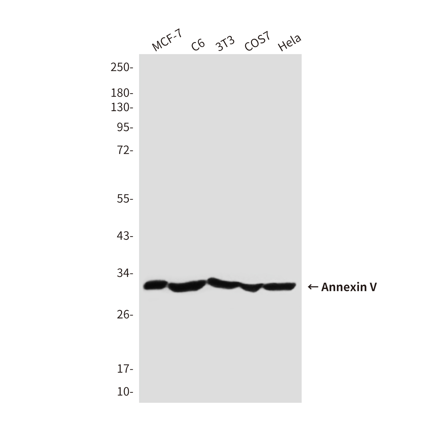 Annexin V
