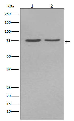 Alkaline Phosphatase