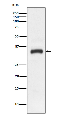 Junctional Adhesion Molecule 1