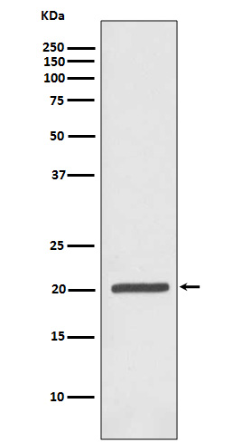 Ferritin Heavy Chain