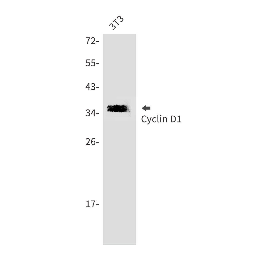Cyclin D1