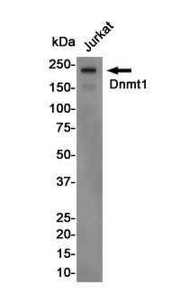 Dnmt1