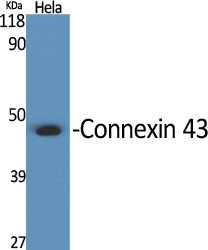 Connexin 43