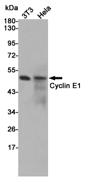 Cyclin E1