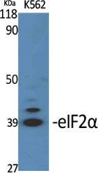 eIF2A