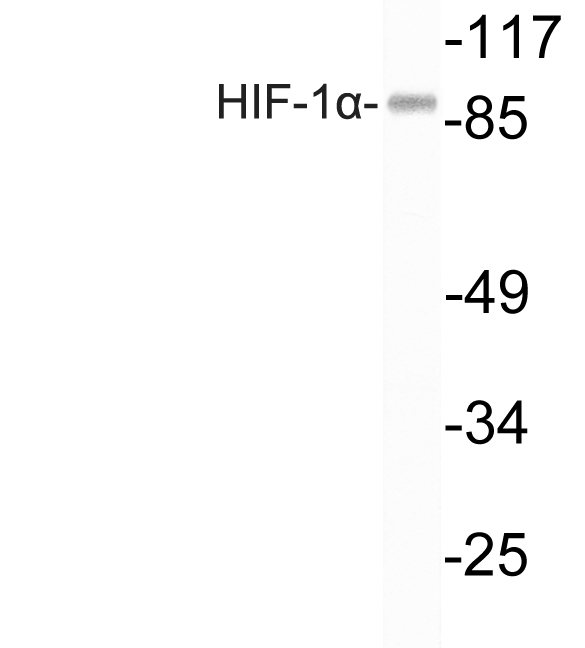 HIF1 alpha