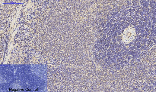 Rabbit Polyclonal Antibody to PPAR gamma