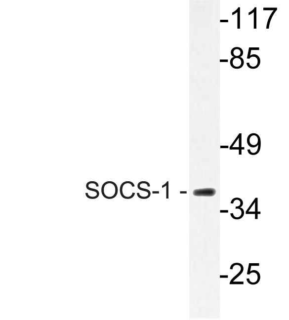 SOCS1