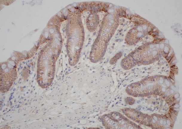 Rabbit Polyclonal Antibody to Claudin 1