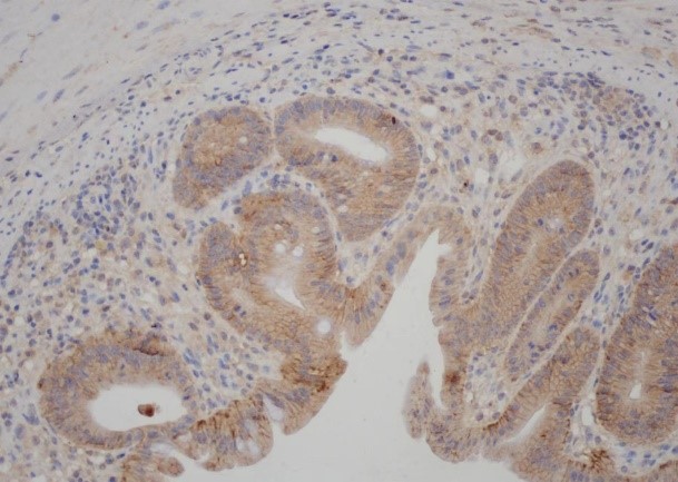 Rabbit Polyclonal Antibody to Claudin 1