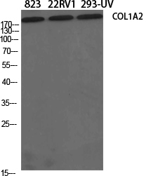 Collagen I alpha 2