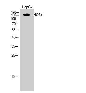 Rabbit Polyclonal Antibody to eNOS