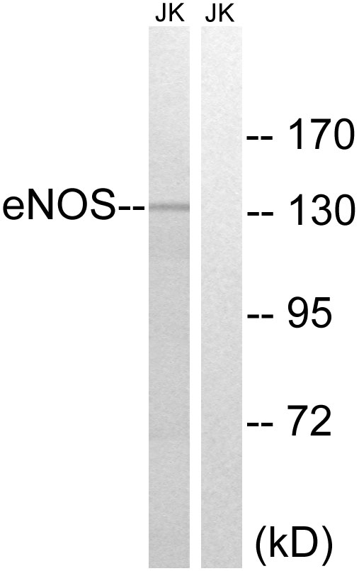 Rabbit Polyclonal Antibody to eNOS