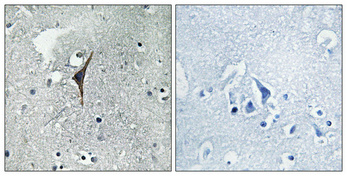 Rabbit Polyclonal Antibody to eNOS