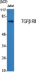 TGF beta Receptor II