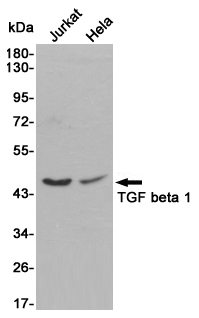 TGF beta 1