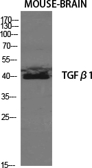 Rabbit Polyclonal Antibody to TGF beta 1