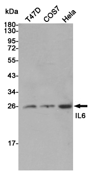 IL-6