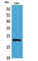 Rabbit Polyclonal Antibody to IL-6