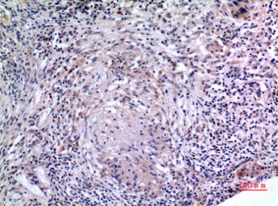 Rabbit Polyclonal Antibody to IL-6
