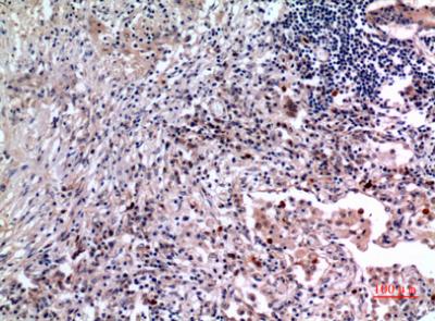 Rabbit Polyclonal Antibody to IL-6
