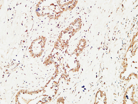 Rabbit Polyclonal Antibody to c-Kit