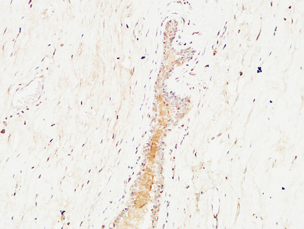 Rabbit Polyclonal Antibody to c-Kit