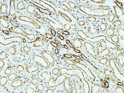 Rabbit Polyclonal Antibody to CD31