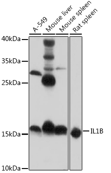 Rabbit Polyclonal Antibody to IL-1 beta