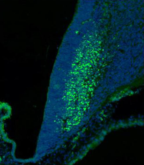 Rabbit Polyclonal Antibody to SKOR2