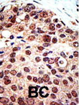 Rabbit Polyclonal Antibody to PRMT3