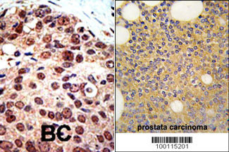 Rabbit Polyclonal Antibody to PRMT3