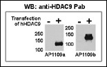 HDAC9 (N-term)