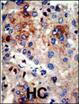 Rabbit Polyclonal Antibody to HDAC9 (N-term)