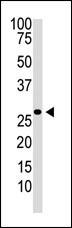 DKK2 (N-term)