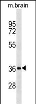 Rabbit Polyclonal Antibody to DKK2 (N-term)