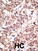 Rabbit Polyclonal Antibody to DKK2 (N-term)