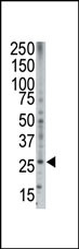 Bok BH3 Domain