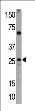 NIP1 (BH3 Domain Specific)