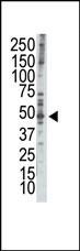 RAD9 (BH3 Domain Specific)