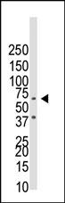 BMPR1B (N-term K15)