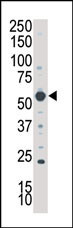 SGK3 (N-term)