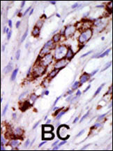 Rabbit Polyclonal Antibody to GRK5