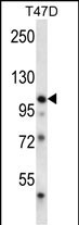 Rabbit Polyclonal Antibody to EphB1